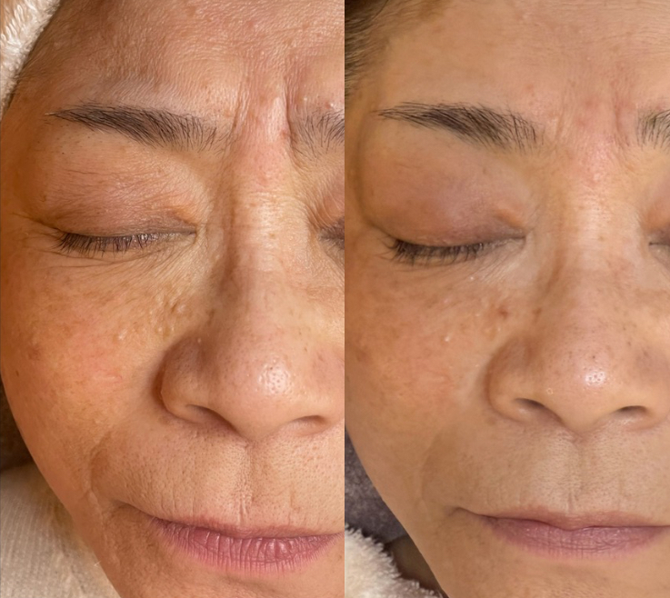 たった1か月でも、こんな変化が